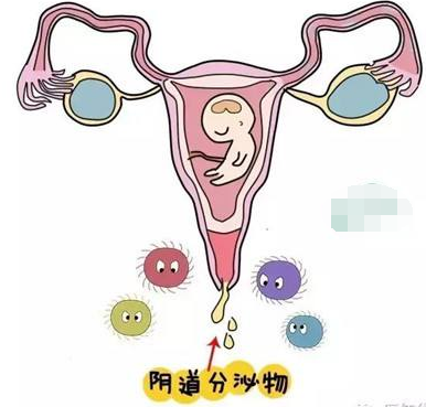 阴道分泌物羞羞视频在线免费看的一般性状检查类型
